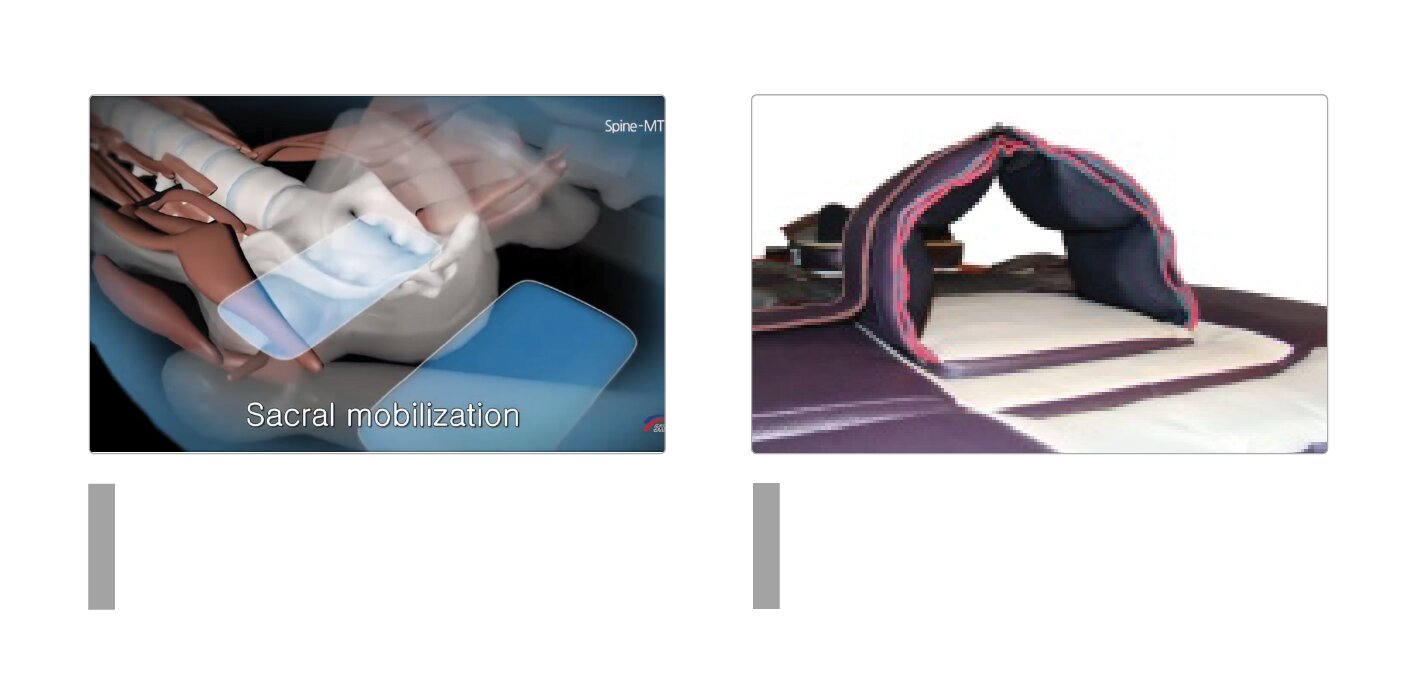 SPINE-MT CORE Treatment in Progress